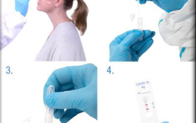 Test Rápidos de Antígenos para Detección del Sars CoV-2