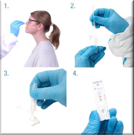 Test Rápidos de Antígenos para Detección del Sars CoV-2